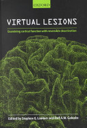 Virtual lesions : examining cortical function with reversible deactivation /