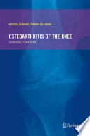 Osteoarthritis of the knee /