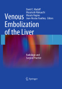 Venous embolization of the liver : radiological and surgical practice /