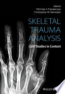 Skeletal trauma analysis : cases studies in context /