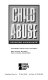 Child abuse : opposing viewpoints /