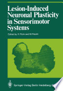 Lesion-induced neuronal plasticity in sensorimotor systems /