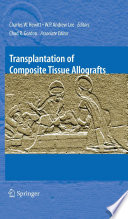 Transplantation of composite tissue allografts /
