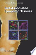 Gut-associated lymphoid tissues /