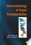 Immunology of organ transplantation /