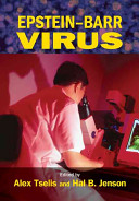 Epstein-Barr virus /