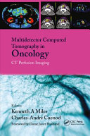 Multidetector computed tomography in oncology : CT perfusion imaging /