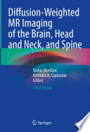 Diffusion-Weighted MR Imaging of the Brain, Head and Neck, and Spine /