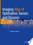 Imaging Atlas of Ophthalmic Tumors and Diseases /