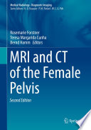 MRI and CT of the Female Pelvis /