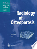 Radiology of osteoporosis /