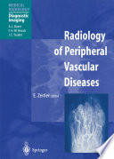 Radiology of peripheral vascular diseases /