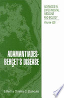 Adamantiades-Behçet's disease /