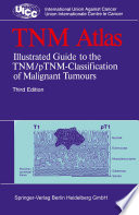 TNM atlas : illustrated guide to the TNM/pTNM classification of malignant tumours /