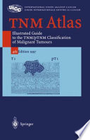 TNM atlas : illustrated guide to the TNM/pTNM classification of malignant tumours /