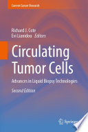 Circulating Tumor Cells : Advances in Liquid Biopsy Technologies /