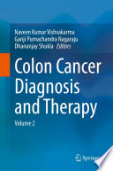 Colon Cancer Diagnosis and Therapy : Volume 2 /