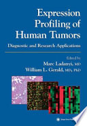 Expression profiling of human tumors : diagnostic and research applications /