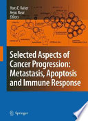 Selected aspects of cancer progression : metastasis, apoptosis and immune response /