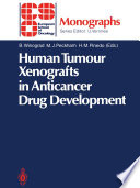 Human tumour xenografts in anticancer drug development /