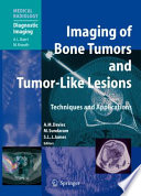 Imaging of bone tumors and tumor-like lesions : techniques and applications /