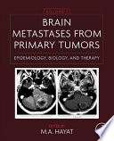 Brain metastases from primary tumors /