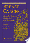 Breast cancer : molecular genetics, pathogenesis, and therapeutics /