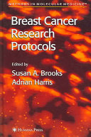 Breast cancer research protocols /