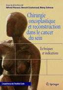 Chirurgie oncoplastique et reconstruction dans le cancer du sein : techniques et indications : l'expérience de l'Institut Curie /