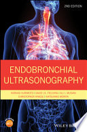 Endobronchial ultrasonography /