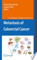 Metastasis of colorectal cancer /