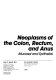 Neoplasms of the colon, rectum, and anus : mucosal and epithelial /