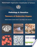 Pathology and genetics of tumours of endocrine organs /