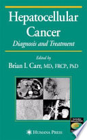 Hepatocellular cancer : diagnosis and treatment /