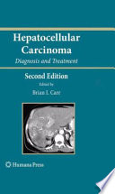 Hepatocellular carcinoma : diagnosis and treatment /