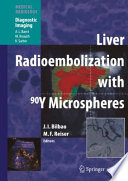 Liver radioembolization with 90Y microspheres /