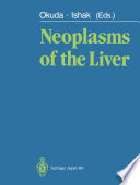 Neoplasms of the liver /