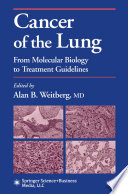 Cancer of the lung : from molecular biology to treatment guidelines /