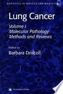 Lung cancer /
