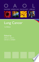 Lung cancer /