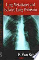 Lung metastases and isolated lung perfusion /