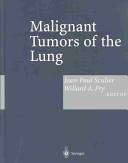 Malignant tumors of the lung : evidence-based management /