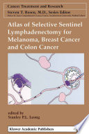 Atlas of selective sentinel lymphadenectomy for melanoma, breast cancer, and colon cancer /