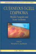 Cutaneous T-cell lymphoma : mycosis fungoides and Sezary syndrome /
