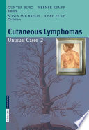 Cutaneous lymphomas : unusual cases 2 /