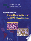 Human lymphoma : clinical implications of the REAL classification /