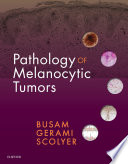 Pathology of melanocytic tumors /