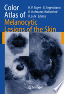 Color atlas of melanocytic lesions of the skin /