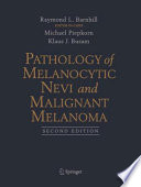 Pathology of melanocytic nevi and malignant melanoma /