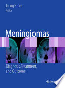 Meningiomas : diagnosis, treatment, and outcome /